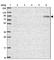 Signal Transducer And Activator Of Transcription 5A antibody, HPA049883, Atlas Antibodies, Western Blot image 