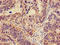 Catenin Delta 1 antibody, LS-C671437, Lifespan Biosciences, Immunohistochemistry paraffin image 