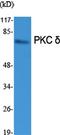 Protein Kinase C Delta antibody, A00822, Boster Biological Technology, Western Blot image 