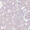 Inhibin Subunit Beta E antibody, PA5-53503, Invitrogen Antibodies, Immunohistochemistry frozen image 