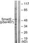 SMAD2 antibody, PA5-38074, Invitrogen Antibodies, Western Blot image 