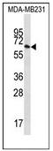 Interferon-induced guanylate-binding protein 1 antibody, AP51791PU-N, Origene, Western Blot image 