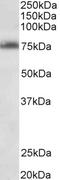 TSPY Like 2 antibody, LS-B11181, Lifespan Biosciences, Western Blot image 