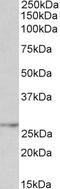 Nicotinamide Nucleotide Adenylyltransferase 3 antibody, EB11023, Everest Biotech, Western Blot image 