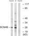 Sodium Voltage-Gated Channel Beta Subunit 4 antibody, abx014894, Abbexa, Western Blot image 