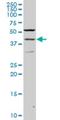 Paired Box 2 antibody, H00005076-M02, Novus Biologicals, Western Blot image 