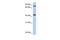 Testis Expressed 9 antibody, GTX45163, GeneTex, Western Blot image 