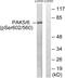 P21 (RAC1) Activated Kinase 5 antibody, abx012707, Abbexa, Western Blot image 