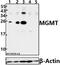 O-6-Methylguanine-DNA Methyltransferase antibody, GTX66683, GeneTex, Western Blot image 