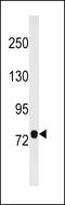 Aminopeptidase O (Putative) antibody, 59-250, ProSci, Western Blot image 