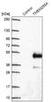 Transmembrane Protein 255A antibody, NBP2-30639, Novus Biologicals, Western Blot image 