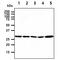 Tyrosine 3-Monooxygenase/Tryptophan 5-Monooxygenase Activation Protein Epsilon antibody, GTX57563, GeneTex, Western Blot image 