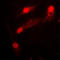 LIM Domain Kinase 2 antibody, LS-C352456, Lifespan Biosciences, Immunofluorescence image 
