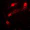 LIM Domain Kinase 2 antibody, LS-C352456, Lifespan Biosciences, Immunofluorescence image 