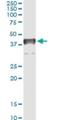 Transcription Elongation Factor A3 antibody, H00006920-M06, Novus Biologicals, Immunoprecipitation image 