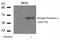 Estrogen Receptor 1 antibody, GTX50139, GeneTex, Western Blot image 