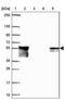 Dystrobrevin Beta antibody, PA5-63950, Invitrogen Antibodies, Western Blot image 