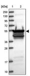 RNA Binding Motif Protein 41 antibody, PA5-60155, Invitrogen Antibodies, Western Blot image 