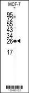 Neuronal Calcium Sensor 1 antibody, 58-187, ProSci, Western Blot image 