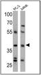 Cannabinoid Receptor 2 antibody, NB300-606, Novus Biologicals, Western Blot image 