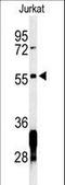 Ring Finger Protein 8 antibody, LS-C162667, Lifespan Biosciences, Western Blot image 