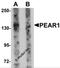 Platelet Endothelial Aggregation Receptor 1 antibody, 6055, ProSci Inc, Western Blot image 