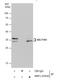 Sulfotransferase 1A1 antibody, NBP1-33550, Novus Biologicals, Western Blot image 