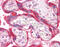 Interleukin 1 Receptor Associated Kinase 1 antibody, 51-474, ProSci, Immunohistochemistry paraffin image 