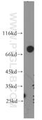 SHC Binding And Spindle Associated 1 antibody, 12672-1-AP, Proteintech Group, Western Blot image 