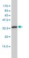 Calcium Binding Protein 39 Like antibody, H00081617-M01, Novus Biologicals, Western Blot image 