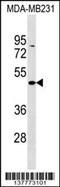 Zinc Finger And BTB Domain Containing 25 antibody, 59-403, ProSci, Western Blot image 