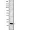 Arachidonate 5-Lipoxygenase Activating Protein antibody, abx148139, Abbexa, Western Blot image 