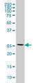 Ribosomal Protein L13 antibody, LS-C198107, Lifespan Biosciences, Western Blot image 