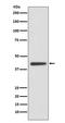 Adiponectin Receptor 1 antibody, M01869, Boster Biological Technology, Western Blot image 