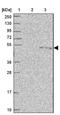 Pseudouridine Synthase 1 antibody, NBP2-13831, Novus Biologicals, Western Blot image 