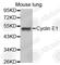 Cyclin E1 antibody, A0112, ABclonal Technology, Western Blot image 
