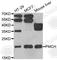 Pro-Melanin Concentrating Hormone antibody, A6692, ABclonal Technology, Western Blot image 