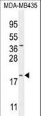 Chromosome 20 Open Reading Frame 173 antibody, LS-C167113, Lifespan Biosciences, Western Blot image 