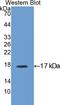 Insulin Like Growth Factor Binding Protein 3 antibody, LS-C294657, Lifespan Biosciences, Western Blot image 