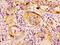 Heat Shock Protein Family B (Small) Member 1 antibody, CSB-PA10869A0Rb, Cusabio, Immunohistochemistry paraffin image 