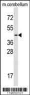 Transcription Factor 7 Like 2 antibody, 56-412, ProSci, Western Blot image 