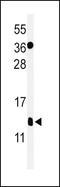 S100 Calcium Binding Protein B antibody, PA5-24996, Invitrogen Antibodies, Western Blot image 
