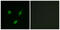 Transforming Acidic Coiled-Coil Containing Protein 1 antibody, GTX87189, GeneTex, Immunocytochemistry image 