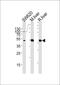 Ornithine Carbamoyltransferase antibody, PA5-35324, Invitrogen Antibodies, Western Blot image 