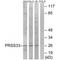 Serine Protease 33 antibody, A16656, Boster Biological Technology, Western Blot image 