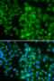 LIM Domain Only 4 antibody, STJ29408, St John
