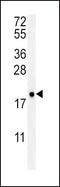 Vitamin K Epoxide Reductase Complex Subunit 1 antibody, PA5-25753, Invitrogen Antibodies, Western Blot image 