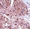 Activin A Receptor Like Type 1 antibody, LS-C97154, Lifespan Biosciences, Immunohistochemistry paraffin image 