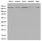 Structural Maintenance Of Chromosomes 1A antibody, LS-C799044, Lifespan Biosciences, Western Blot image 