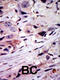 ALK Receptor Tyrosine Kinase antibody, 63-026, ProSci, Immunohistochemistry paraffin image 